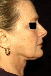 After Image