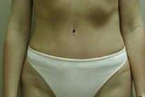 After Image