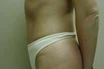 After Image