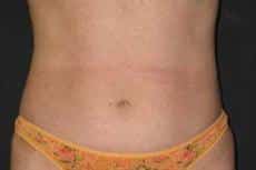 After Image