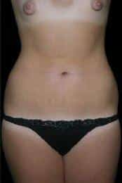 After Image