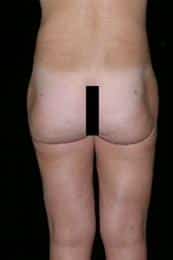 After Image