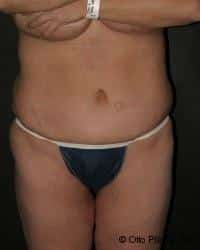 After Image
