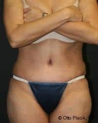 After Image