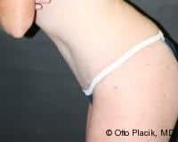 After Image