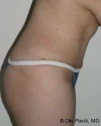 After Image