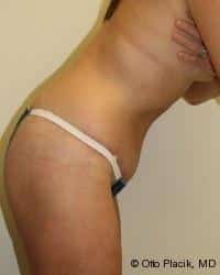 After Image
