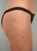 After Image