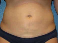 After Image