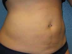 After Image