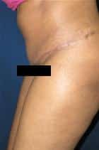 After Image