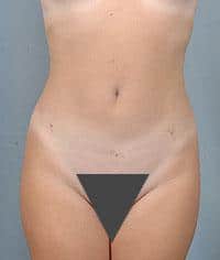 After Image