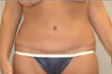 After Image