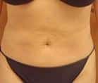 After Image