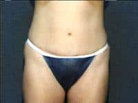 After Image