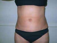 After Image