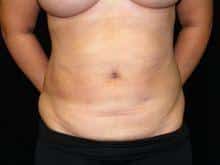 After Image