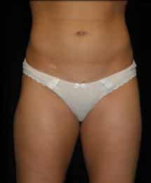 After Image