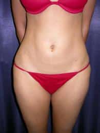 After Image