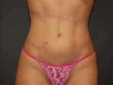 After Image