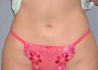 After Image