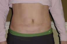 After Image
