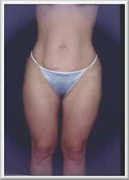 After Image