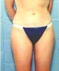 After Image