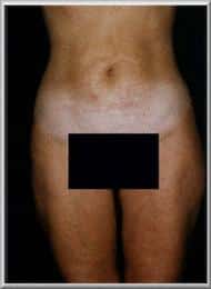 After Image
