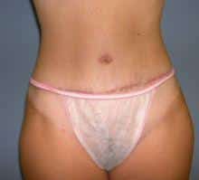 After Image