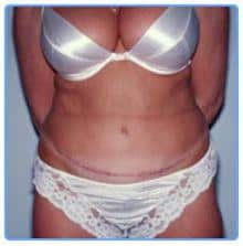 After Image