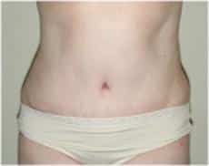 After Image