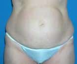 After Image