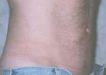 After Image