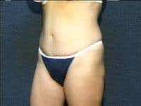 After Image