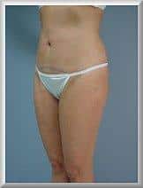 After Image