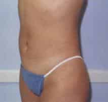 After Image