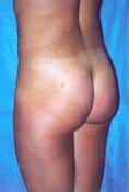 After Image