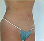 After Image
