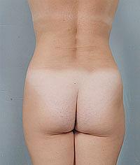 After Image
