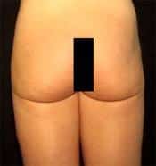 After Image