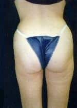 After Image