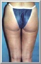 After Image