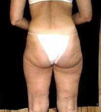 After Image