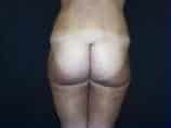 After Image