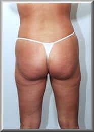 After Image
