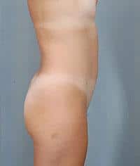 After Image