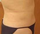 After Image