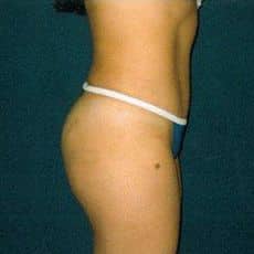 After Image