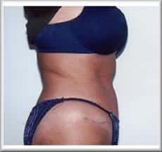 After Image